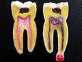Toothache