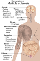 esclerosis múltiple