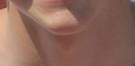Piel