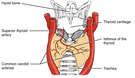 Glándula tiroide